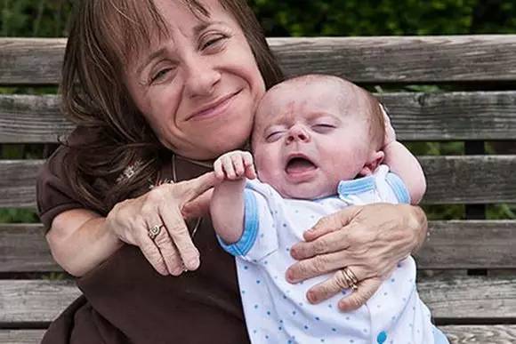 罕见病儿童时期发病,究竟罕见病孩子应该治疗还是放弃