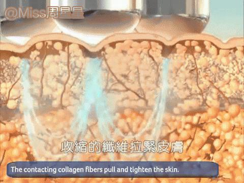 那些坑爹的美妆产品,平价美容仪到底有没有用