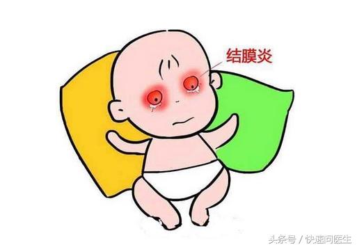 白眼球发黄怎么回事结膜炎,结膜炎白眼球为什么越来越红