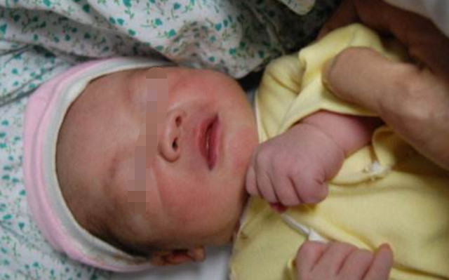 胎儿头部已生出，肩膀却被卡住“拖不动”