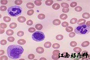 医院化验单参考值怎么看,医院化验单视频教程