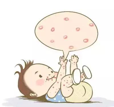 宝宝湿疹老不好原来是这些原因,湿疹老不好其实根除它只用1招