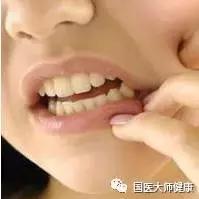 牙痛不是病起来真要命,医生总结了5种牙痛止痛方法
