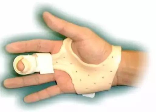 手受外伤不能吃什么,手外伤的康复治疗目标