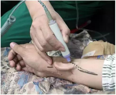 丹麦生蚝泛滥解决办法,丹麦生蚝泛滥的解决办法