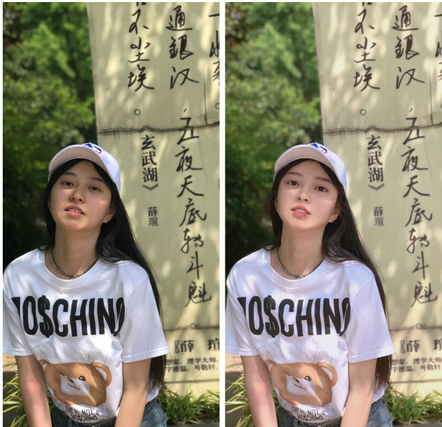 凤姐手滑点赞的东南亚整容妖术，堪比回炉再造！