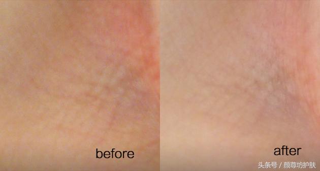 高级抗老精华,抗老精华胜肽紧致最有效果的