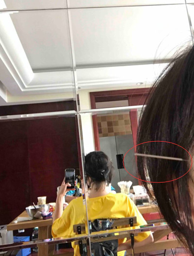 郑爽患病不敢去医院自己在家针灸，一句话透露她内心恐惧与不安！