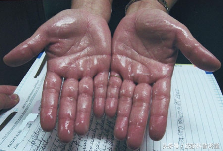 痛苦的时候应该怎么办,痛苦的症状和治疗方法