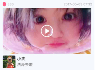 郑爽压力大深夜失眠嘴角上火，早晨起床头发凌乱不忘卖萌放飞自我