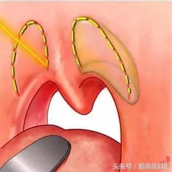 明星真人秀最尴尬的可能不是撕破脸，而是发出这种声音