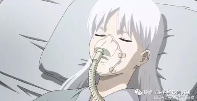 男人两鬓白发能恢复吗,紧张焦虑白发怎么恢复