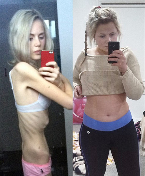 600多斤的胖妞减肥成功瘦到130斤,150斤胖妞