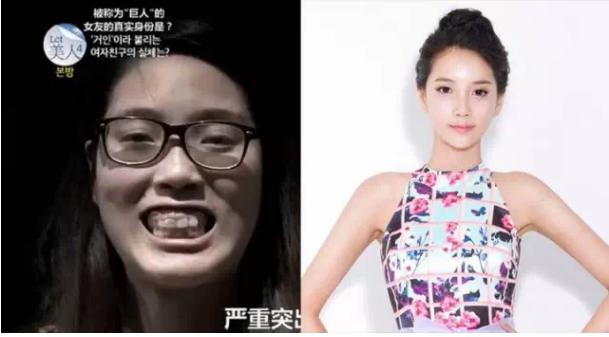 韩国整容手术恢复过程,韩国一个整容的综艺节目