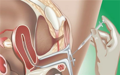 做试管婴儿到底有多遭罪?想要个孩子好难!真心心疼女性一万遍!