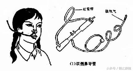 常用的氧疗方法有哪些,氧疗的最佳方法