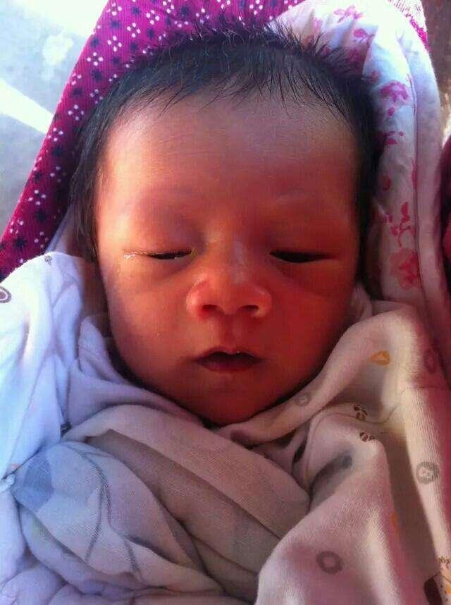 7个月婴儿泪腺不通要动手术吗,新生儿泪腺管不通怎么办