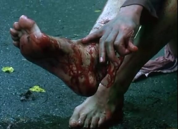 哎呀！不小心脚丫子踩到玻璃碎片上