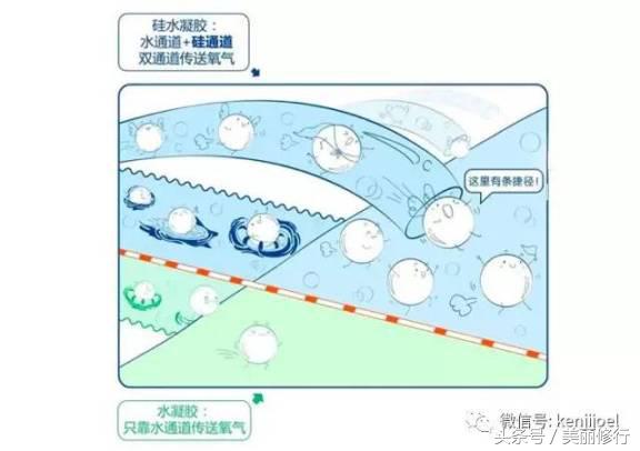 隐形眼镜有关知识答题,美瞳隐形眼镜的全部知识
