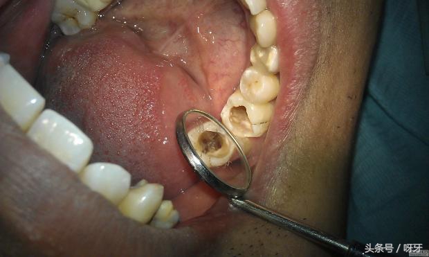 医院牙科暴利行业,牙科暴利行业什么时候整治