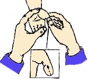 婴儿胃部受凉驱寒小妙招,小儿推拿胃寒手法