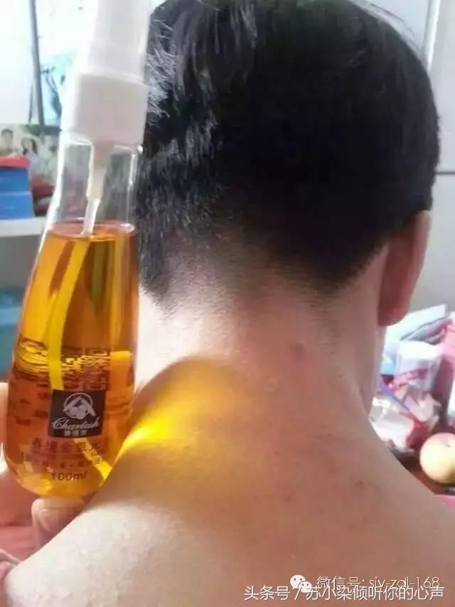 沙棘油，对皮肤还有如此神奇的效果