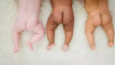 初生婴儿痣和胎记怎么区别,孩子长痣和胎记区别