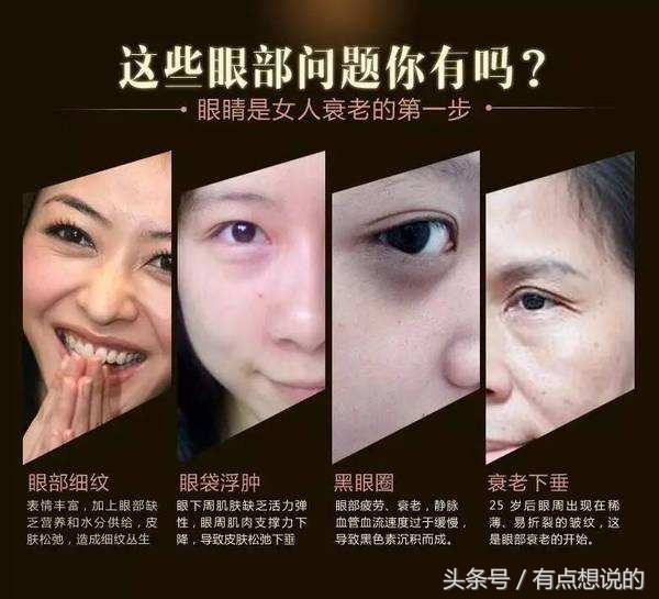 端午特刊｜如何对抗黑眼圈这个一生之敌？