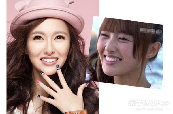 法令纹显老明星,明星怎么治法令纹