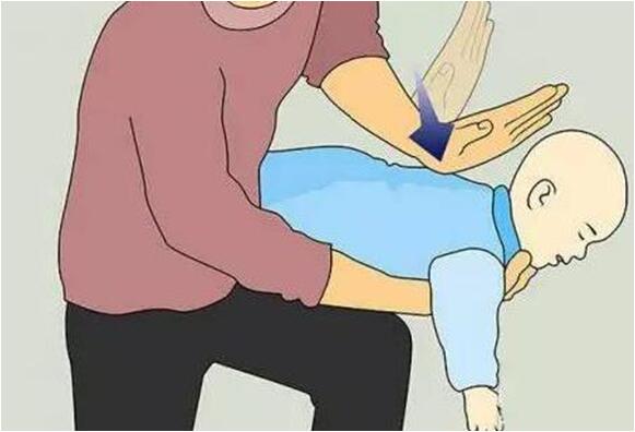 气管异物海姆立克急救法视频,气管有异物急救法叫什么名字