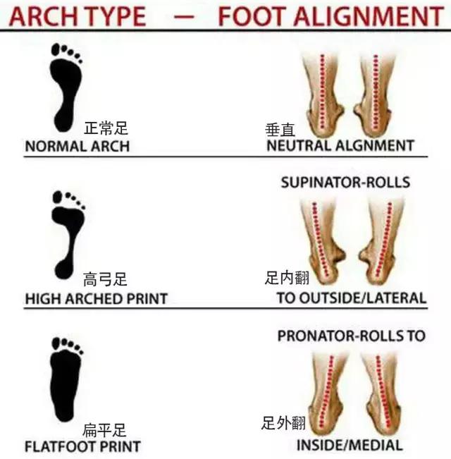 长时间走路脚跟痛怎么解决,足弓和脚后跟痛怎么回事