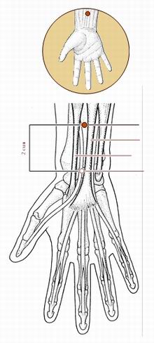 胁痛针灸,胁肋疼痛董氏针灸取穴处方