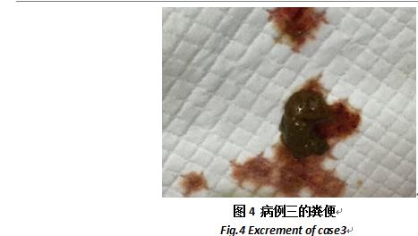 担心狗狗得狗瘟怎么办,狗狗得了犬瘟热怎么治