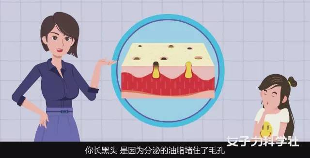 医美去黑头缩毛孔一次大概多少钱,壬二酸和水杨酸去黑头缩毛孔用法