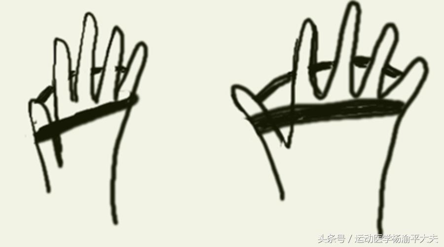 治疗高尔夫球肘的药膏,高尔夫球肘的康复方法