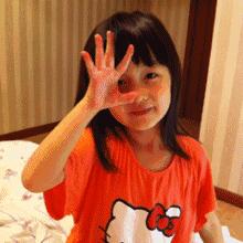 经常吃面食会得湿疹吗,吃面食容易引起湿疹