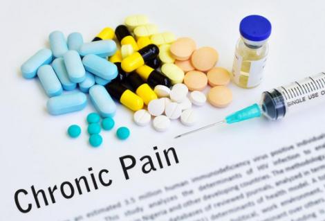 身体的各种疼痛,我们的身体是如何工作的