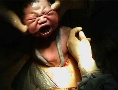 49天无痛引产的真实经历,39天引产过程步骤