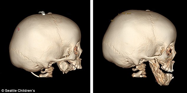 没有下巴的女孩长什么样子,一出生就没有胳膊的女孩