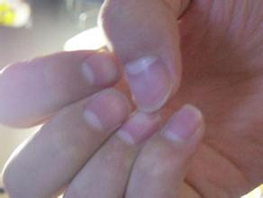 一般来说健康的指甲是什么样子,健康指甲的正常颜色