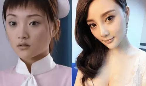 鼻子垫的太往上了,鼻子垫得不高是不是不容易歪