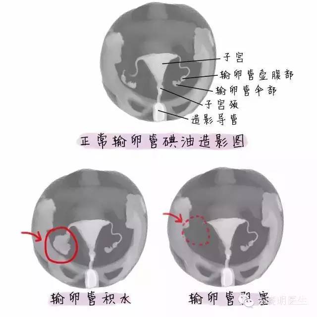 究竟为什么怀不上孩子