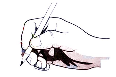 脑瘫孩子腕指关节屈曲、拇指内收训练