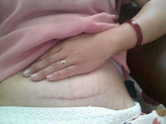 剖腹产后的恶露是大姨妈吗,关于恶露产后宝妈必须要知道的事