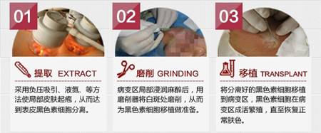 白癜风自体表皮移植全过程,白癜风表皮移植半个月还是白色的