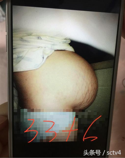 成都妈妈诞下同卵三胞胎5天准备了12包尿不湿