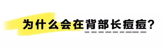 第二天要穿吊带如何解决背后痘痘,后背有痘痘穿吊带的急救办法