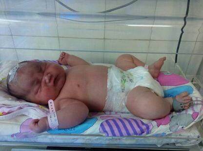 体重200斤的孕妇生孩子，医生说孩子像是在脂肪里抱出来的！