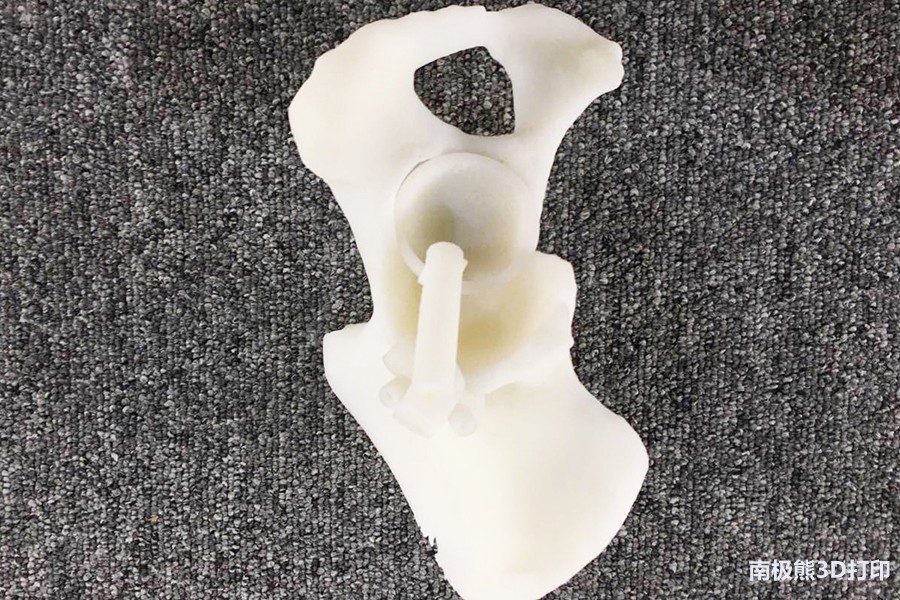 华曙高科3D打印辅助全髋关节置换术成功率达100%