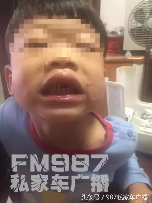 孩子门牙被撞了,小孩被撞门牙磕断对方家长不承认
